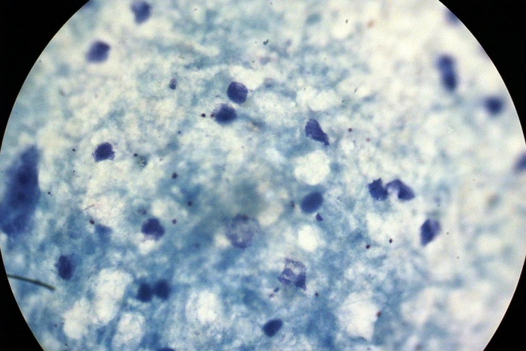 Австралийские ученые выявили угрозу супербактерий для младенцев