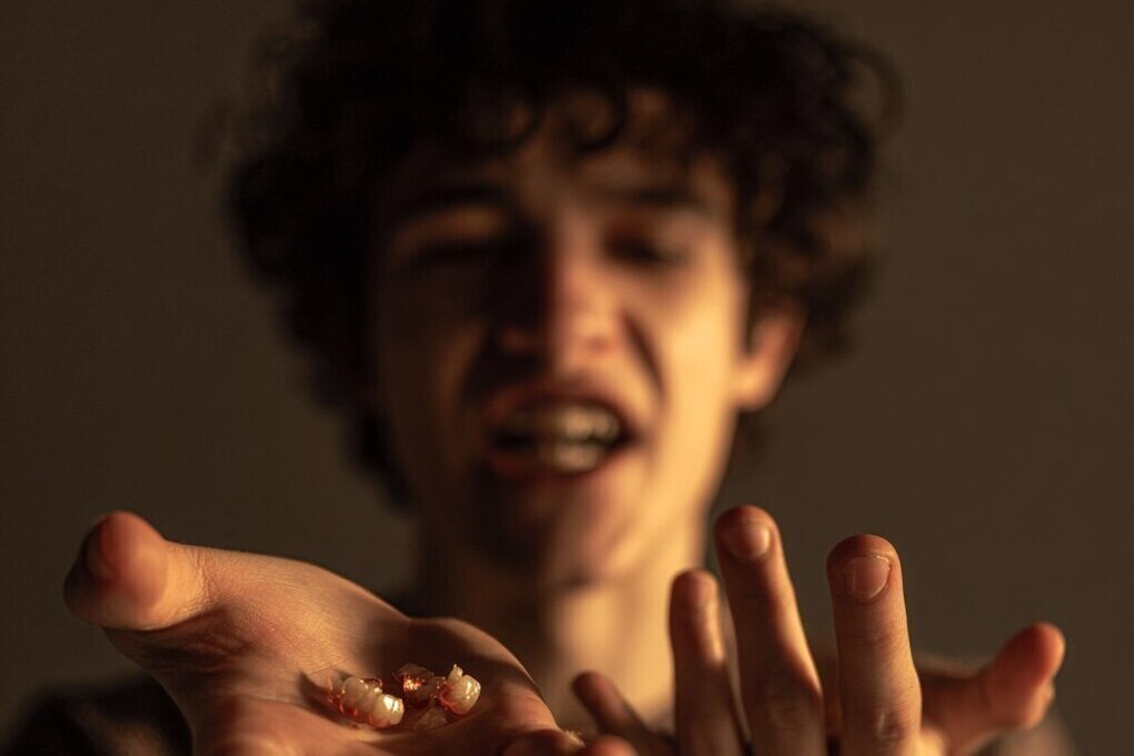 Perdita dei denti e mortalità: uno studio rivela un legame preoccupante tra la perdita rapida dei denti e il rischio di morte negli anziani