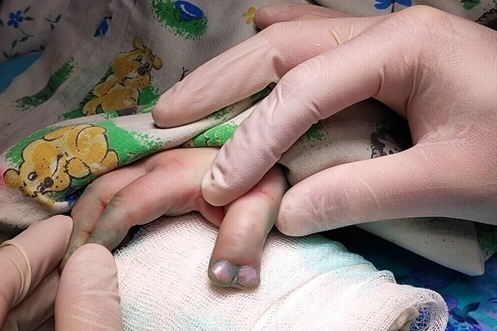 Во Владимире прооперирован ребенок с редкой аномалией