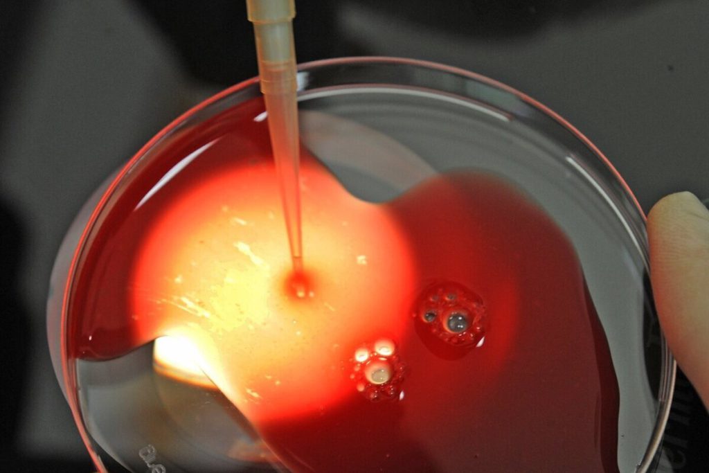 Screening Genetico Prenatale e Intelligenza Artificiale: un Nuovo Passo Avanti per la Salute Pubblica con il Sistema Sanitario Nazionale