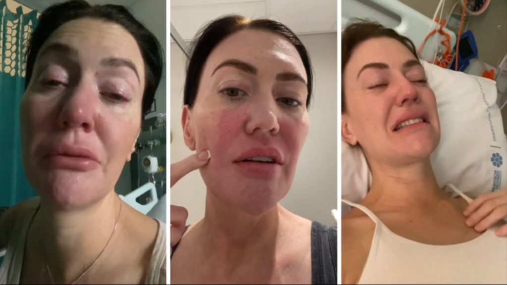 Mide ağrısını aylarca görmezden geldi, acı gerçek hastanede ortaya çıktı! &quot;Vücudumun verdiği bir sinyalmiş&quot;