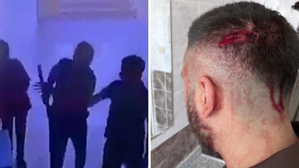 Insegnante Aggredito a Şanlıurfa: Un Atto di Violenza che Sottolinea la Necessità di Maggiore Sicurezza e Rispetto nel Sistema Educativo