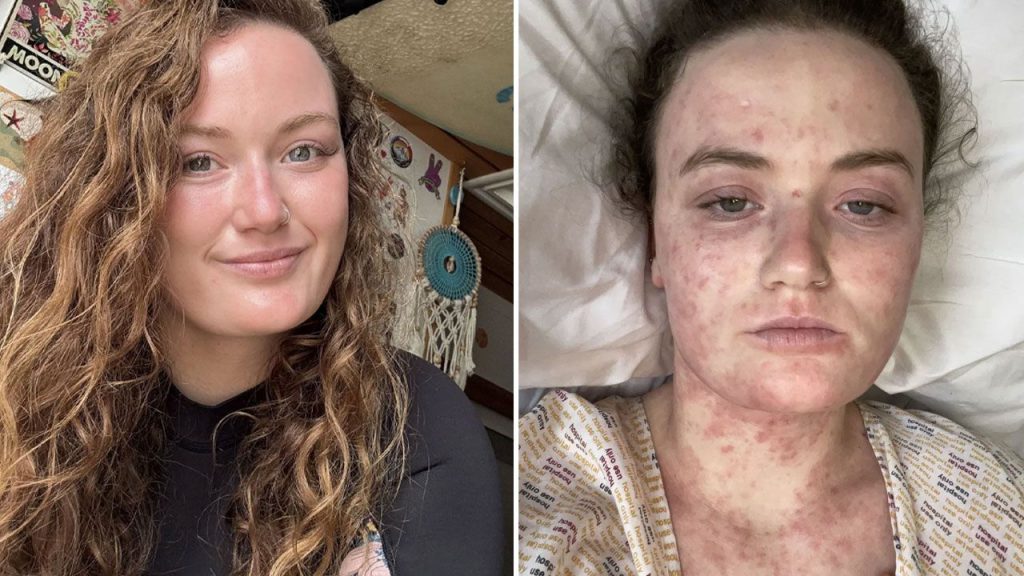 Yoğun sırt ağrısı alarm verdi, saatler içinde kötüleşti! Yanlış teşhis az kalsın canından ediyordu