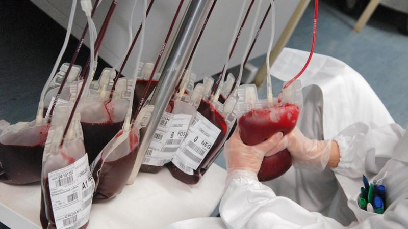 Morte di pensionata per trasfusione errata: procuratore richiede arresto del cardiochirurgo Sorrentino