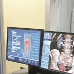 Mal di schiena, un problema diffuso nel Piemonte: come prevenirlo con uno stile di vita sano