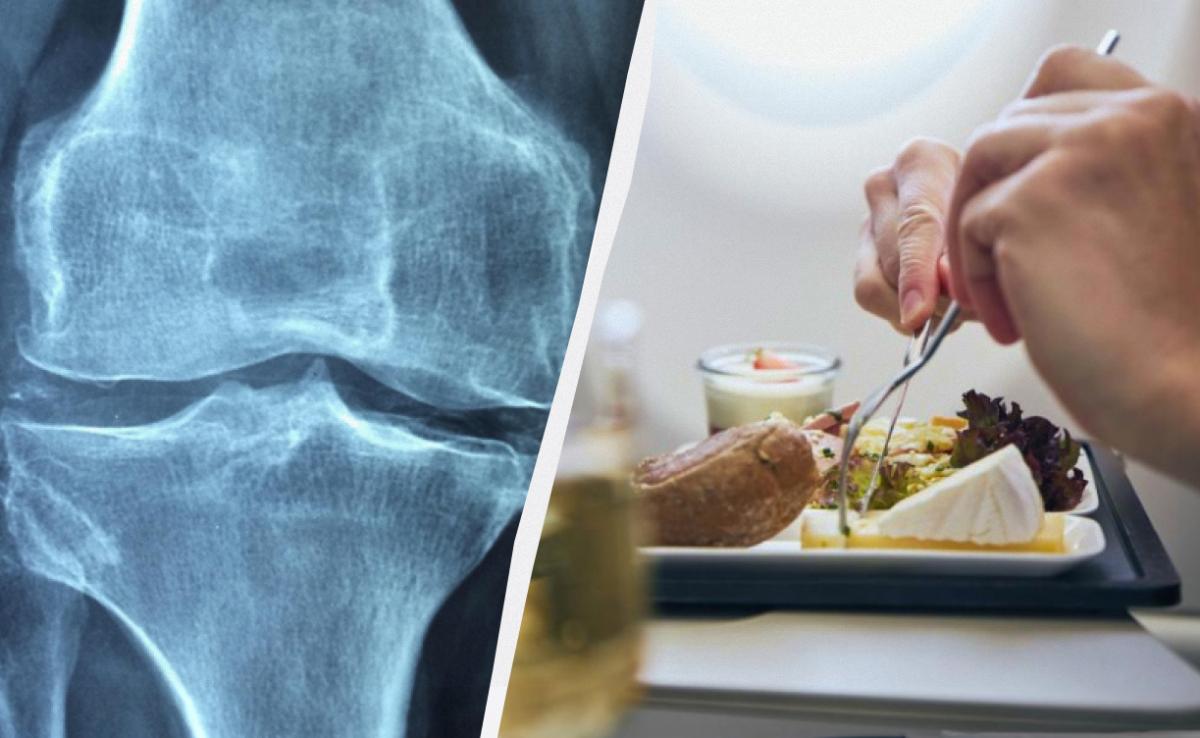 Un alimento ricco di calcio, vitamina D, magnesio, vitamina K e proteine: la chiave per la salute delle ossa