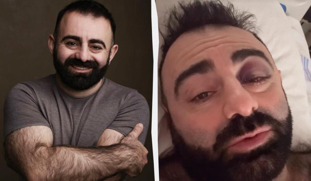 Attore del film “Skaženogo veseľlya” ricoverato in neurochirurgia dopo caduta nella sala di orchestra