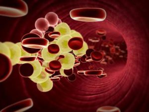 Nuove speranze per il colesterolo: terapie innovative per un futuro più sano