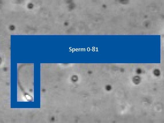 La prima gravidanza con l&#039;Intelligenza artificiale: «Ha trovato gli unici due spermatozoi &quot;attivi&quot; di un 39enne»