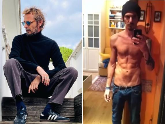 Laerte Pappalardo racconta la sua lotta contro l&#039;anoressia dopo la partecipazione a L&#039;Isola dei Famosi