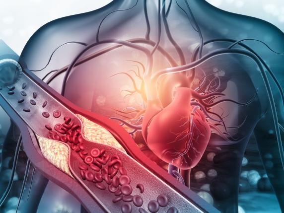 Le fibre alimentari: come aiutano a mantenere pulite le arterie e prevenire infarti e ictus