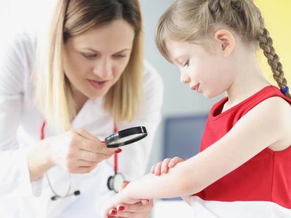 La Psoriasi Guttata nei Bambini e Adolescenti: Cosa Sapere e Come Curarla