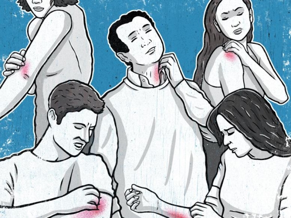 Prurito che non passa: capire le cause e trovare soluzioni