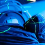 Radioterapia: 70 % dei pazienti non riportano effetti collaterali significativi, secondo uno studio