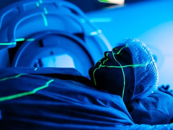 Radioterapia: 70 % dei pazienti non riportano effetti collaterali significativi, secondo uno studio