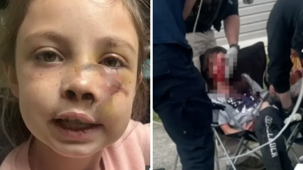 Alabama: attacco di cane lascia bambina gravemente ferita