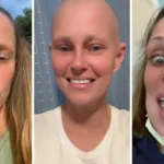 Dente infetto: l'abscessa di Nancy Major si è evoluta in un tumore maligno