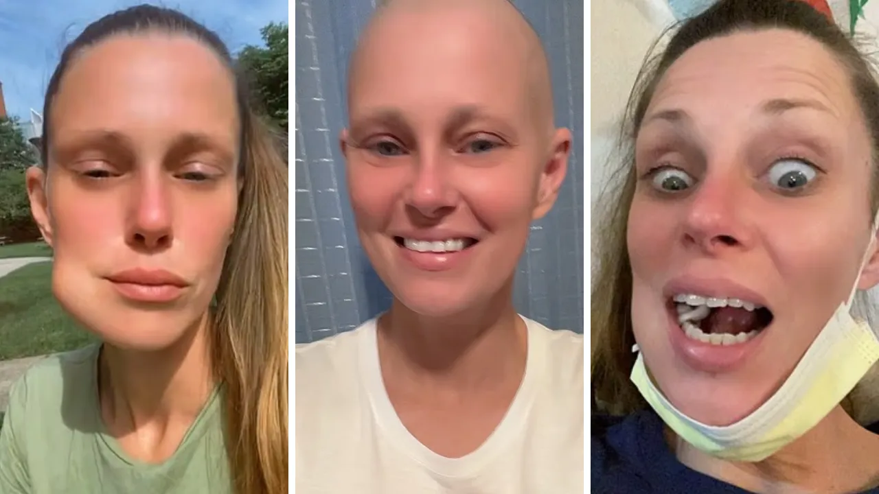 Dente infetto: l'abscessa di Nancy Major si è evoluta in un tumore maligno