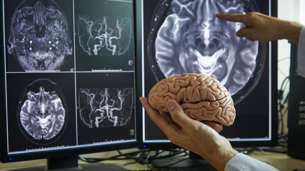 Parlare più di una lingua può rallentare l&#039;invecchiamento cerebrale e ridurre il rischio di declino cognitivo