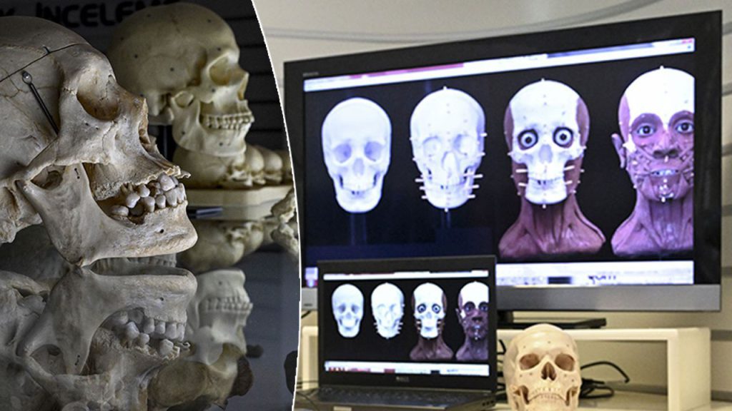 La Scienza aiuta a Risolvere i Misteriosi Omicidi in Turchia con la Ricostruzione del Volto