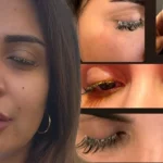 Incidente in centro estetico di Istanbul: adesivo per ciglia finito nell'occhio provoca perdita parziale della vista e denuncia di molestie