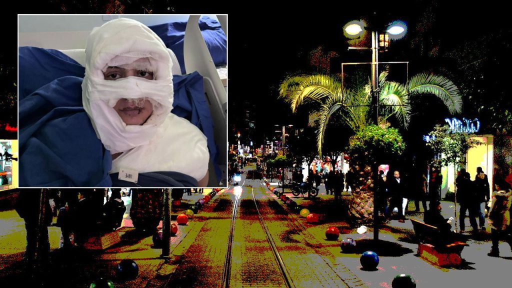 Donna di 33 anni vittima di un attacco brutale a Kadıköy: ustioni gravi e arresto dell&#039;aggressore