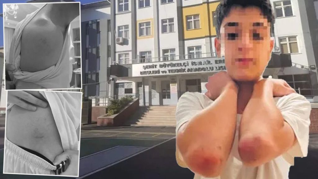 Scandalo a Istanbul: insegnante di educazione fisica impone punizione estrema agli studenti