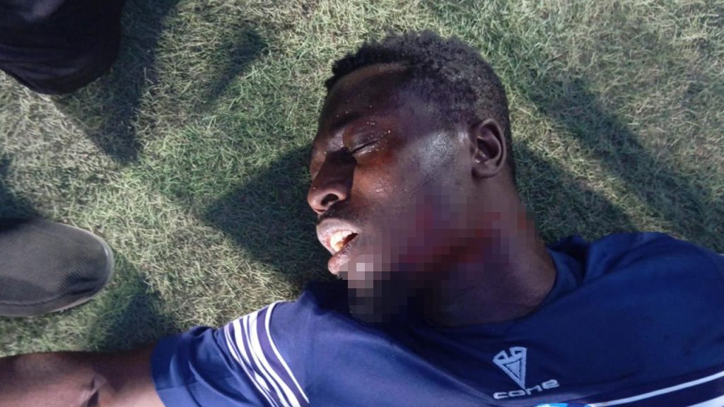 Violenza nello stadio: un tifoso attacca un giocatore durante una partita di calcio in Nigeria
