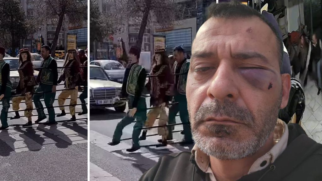 Attacco violento contro l&#039;artista di marionette Adem Ocaktan e la sua famiglia in Turchia: un caso che solleva questioni importanti sulla violenza domestica e sul sostegno alle vittime

Introduzione
Un evento scioccante si è verificato a Kayseri, in Turchia, dove Adem Ocaktan, noto artista di marionette e fenomeno dei social media, è stato vittima di un attacco violento insieme al fratello e al figlio tredicenne.

Il fatto
Secondo le informazioni disponibili, l&#039;aggressione è avvenuta nel luogo di lavoro di Adem Ocaktan e ha coinvolto la sua ex moglie, che è in procinto di divorziare, e altri membri della sua famiglia. Le immagini dell&#039;aggressione sono state catturate dalle telecamere di sicurezza.

Conseguenze dell&#039;attacco
Adem Ocaktan ha riferito che suo fratello è stato gravemente ferito nell&#039;attacco e che suo figlio tredicenne ha subito un trauma psicologico a seguito dell&#039;aggressione. La notizia di questo evento ha suscitato grande preoccupazione e condanna tra i fan e i sostenitori di Adem Ocaktan.

Approfondimento
L&#039;incidente solleva questioni importanti sulla violenza familiare e sulle conseguenze psicologiche che possono derivarne, soprattutto per i minori coinvolti. È fondamentale che tali situazioni vengano affrontate con serietà e che vengano fornite adeguate misure di supporto alle vittime.

Possibili Conseguenze
Le conseguenze di questo attacco potrebbero essere lungimiranti, non solo per Adem Ocaktan e la sua famiglia, ma anche per la comunità più ampia. Potrebbero includere un aumento della consapevolezza sulla violenza domestica e sull&#039;importanza di un sostegno adeguato per le vittime.

Opinione
È importante notare che la violenza non è mai una soluzione e che è cruciale cercare aiuto e supporto in situazioni di conflitto. La comunità deve unirsi per condannare tali atti di violenza e per offrire sostegno a coloro che ne sono stati colpiti.

Analisi Critica dei Fatti
L&#039;analisi dei fatti rivela la necessità di un approccio più comprensivo per affrontare la violenza domestica, che include non solo il sostegno alle vittime, ma anche la prevenzione e l&#039;educazione sulla non violenza.

Relazioni con altri fatti
Questo incidente si inserisce in un contesto più ampio di violenza domestica e di abusi che avvengono in tutto il mondo. È importante riconoscere che tali eventi non sono isolati e che richiedono un&#039;attenzione e un impegno collettivi per essere prevenuti.

Contesto storico
La violenza domestica è un problema che affligge le società da secoli, con radici profonde nella cultura e nelle strutture sociali. Affrontare questo problema richiede un cambiamento culturale e sociale profondo.

Fonti
La fonte di questo articolo è Hurriyet. Per ulteriori informazioni, si prega di visitare il sito web ufficiale della fonte.