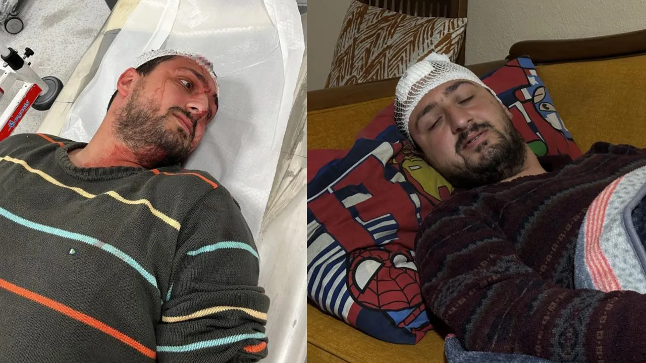 Violenza contro ragazzo autistico a Kocaeli: aggressore arrestato